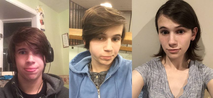 Male To Female Before After Photos MTF M2F Trans Woman. 